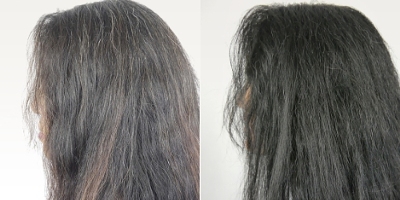 Scientific Discovery Reverses Gray Hair To Its Natural Color